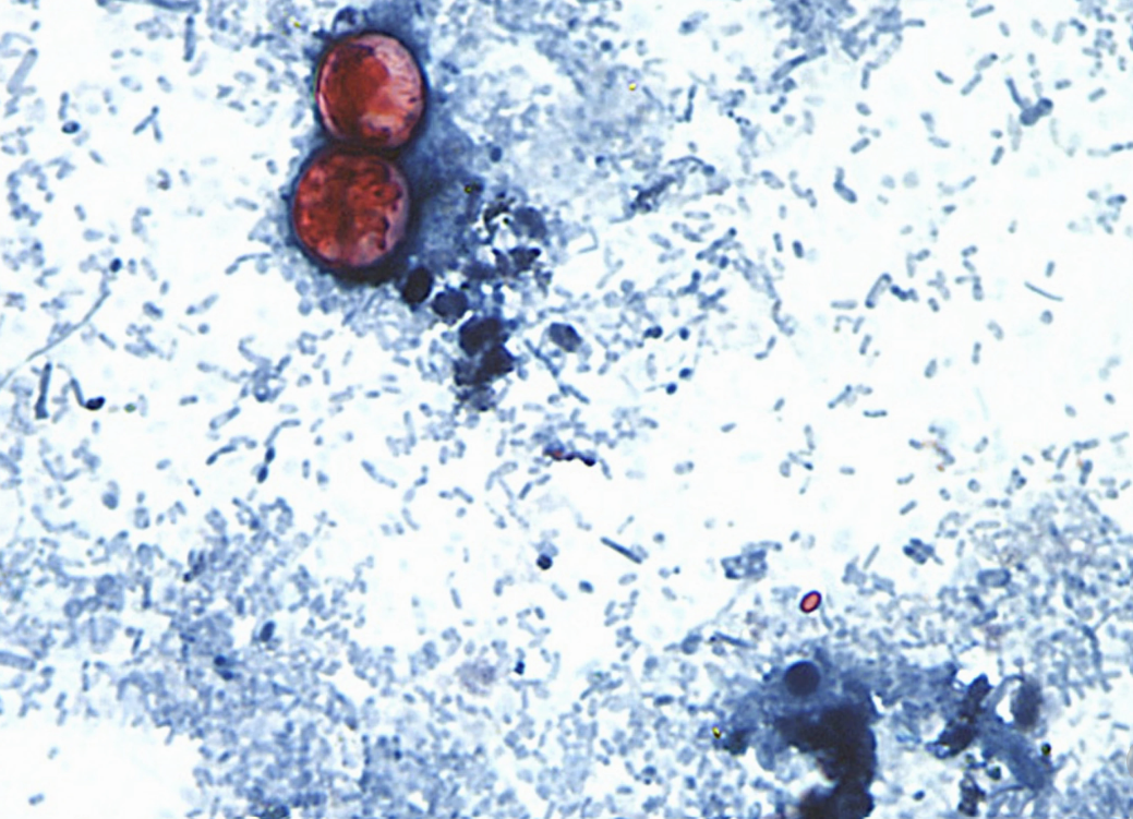 US health officials are investigating a new outbreak of a diarrhea-causing parasite